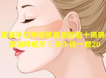 芜湖半口种植修复医院前十揭晓(芜湖种植牙 ☘ 多少钱一颗2021价格表)